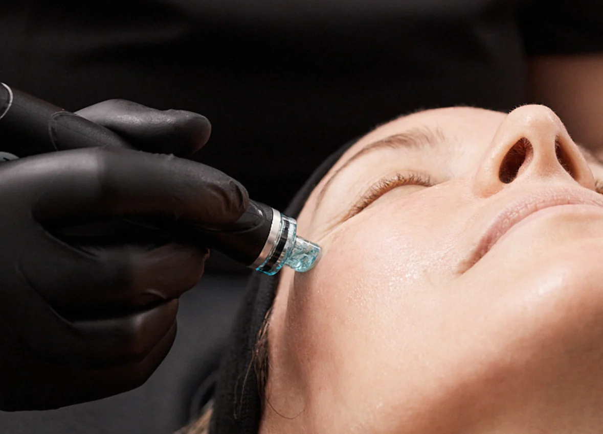 Hydrafacial Syndeo - A prémium bőrmegújítás új generációja